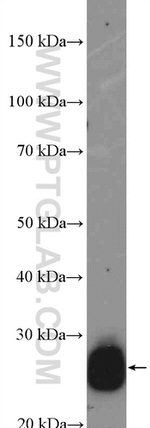 RAB27A Antibody in Western Blot (WB)