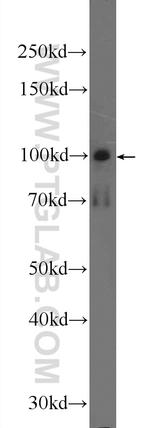 SNCAIP Antibody in Western Blot (WB)
