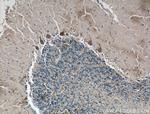 CACNA1G Antibody in Immunohistochemistry (Paraffin) (IHC (P))