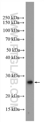 RAB1B Antibody in Western Blot (WB)