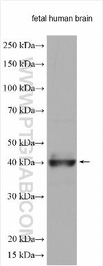 RAB3IL1 Antibody in Western Blot (WB)