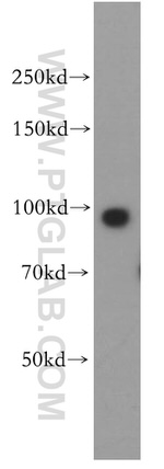 TNPO2 Antibody in Western Blot (WB)