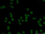 USP21 Antibody in Immunocytochemistry (ICC/IF)