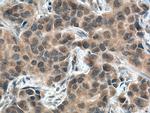 USP21 Antibody in Immunohistochemistry (Paraffin) (IHC (P))