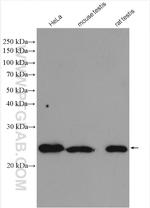 THOC7 Antibody in Western Blot (WB)