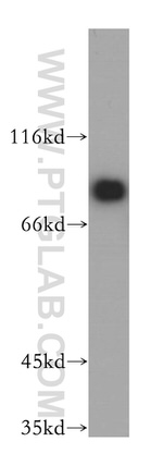 EIF4B Antibody in Western Blot (WB)