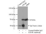 EIF4B Antibody in Immunoprecipitation (IP)