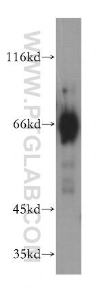 Acetylcholinesterase Antibody in Western Blot (WB)