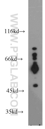 Acetylcholinesterase Antibody in Western Blot (WB)