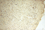 DNA polymerase beta Antibody in Immunohistochemistry (Paraffin) (IHC (P))