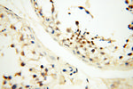 DNA polymerase beta Antibody in Immunohistochemistry (Paraffin) (IHC (P))