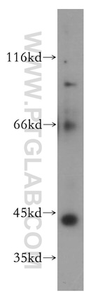 ST8SIA3 Antibody in Western Blot (WB)