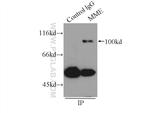 MME/CD10 Antibody in Immunoprecipitation (IP)