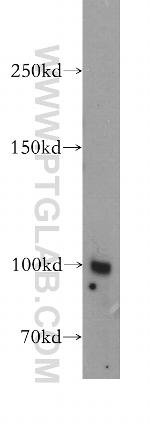 MME/CD10 Antibody in Western Blot (WB)