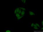 PLAG1 Antibody in Immunocytochemistry (ICC/IF)