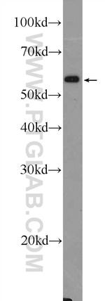 PLAG1 Antibody in Western Blot (WB)