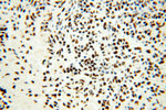SART3 Antibody in Immunohistochemistry (Paraffin) (IHC (P))