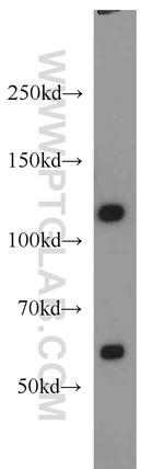 SART3 Antibody in Western Blot (WB)