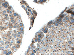TNKS Antibody in Immunohistochemistry (Paraffin) (IHC (P))