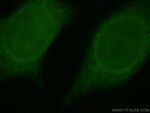 SERPINB13 Antibody in Immunocytochemistry (ICC/IF)