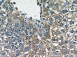 fetuin-B Antibody in Immunohistochemistry (Paraffin) (IHC (P))
