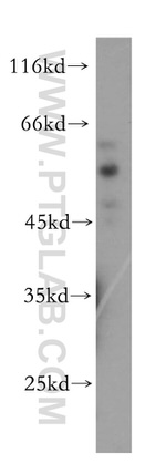 fetuin-B Antibody in Western Blot (WB)
