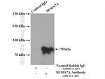 SEMA7A Antibody in Immunoprecipitation (IP)