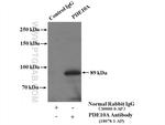 PDE10A Antibody in Immunoprecipitation (IP)