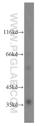 PGLYRP3 Antibody in Western Blot (WB)