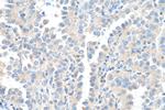 TEC Antibody in Immunohistochemistry (Paraffin) (IHC (P))