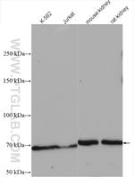 TEC Antibody in Western Blot (WB)