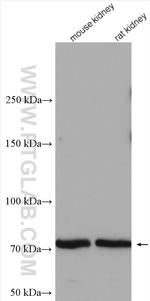 TEC Antibody in Western Blot (WB)