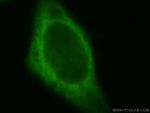 FARSA Antibody in Immunocytochemistry (ICC/IF)