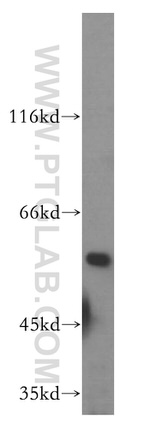 RAB11FIP2 Antibody in Western Blot (WB)