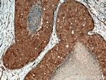 MMP13 Antibody in Immunohistochemistry (Paraffin) (IHC (P))