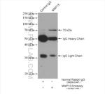 MMP13 Antibody in Immunoprecipitation (IP)