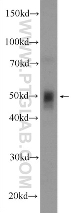 MMP13 Antibody in Western Blot (WB)