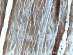 AMPK alpha 2 Antibody in Immunohistochemistry (Paraffin) (IHC (P))