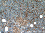 AMPK alpha 2 Antibody in Immunohistochemistry (Paraffin) (IHC (P))