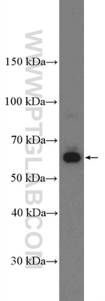 AMPK alpha 2 Antibody in Western Blot (WB)