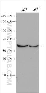 AMPK alpha 2 Antibody in Western Blot (WB)