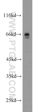 HEPACAM Antibody in Western Blot (WB)