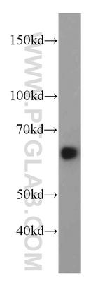 HEPACAM Antibody in Western Blot (WB)