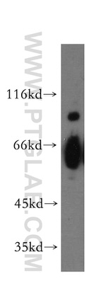 HEPACAM Antibody in Western Blot (WB)