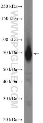 HEPACAM Antibody in Western Blot (WB)