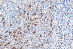 Cyclin A2 Antibody in Immunohistochemistry (Paraffin) (IHC (P))