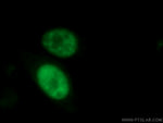 Cyclin A2 Antibody in Immunocytochemistry (ICC/IF)