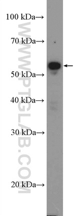 Cyclin A2 Antibody in Western Blot (WB)