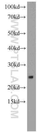 RPS9 Antibody in Western Blot (WB)
