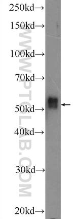 IRAK4 Antibody in Western Blot (WB)